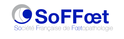 logo SoFFoet.png